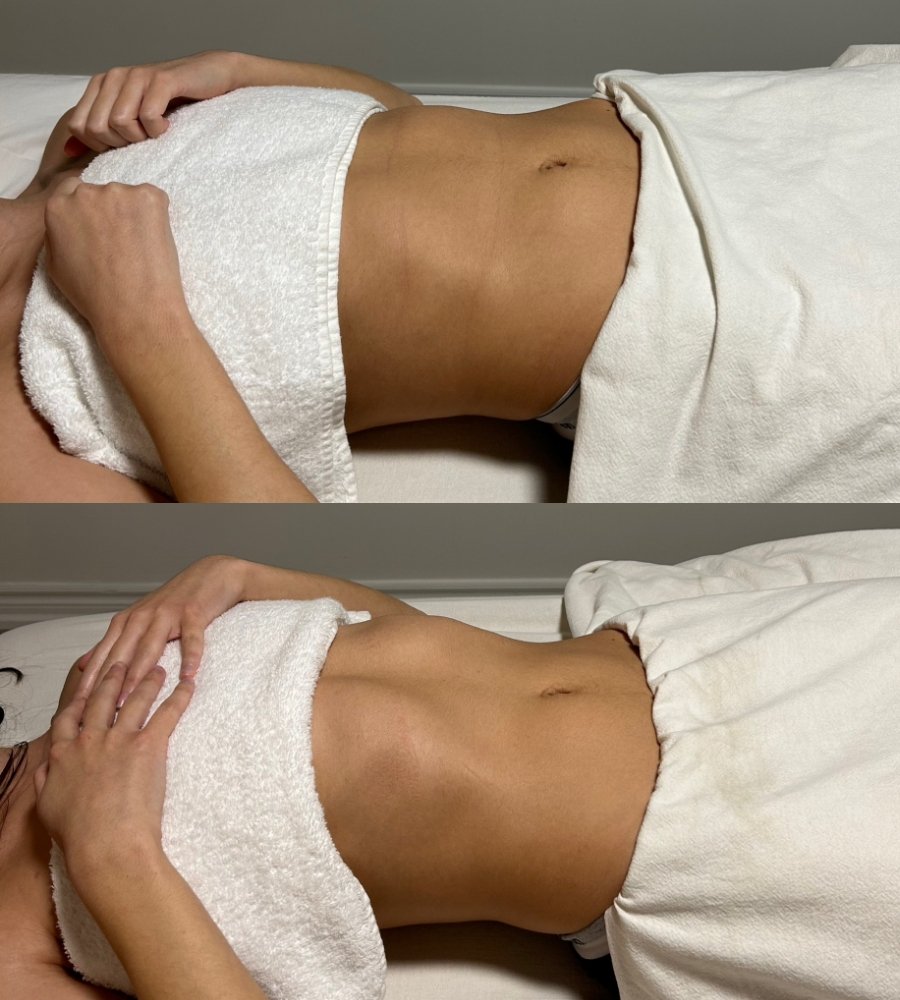 Brazilian-Lymphatic-Drainage-Massage Brazilian-Lymphatic-Drainage-Massage